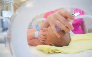 Noworodek podczas USG przezciemiączkowego w szpitalu Salve