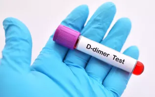D-dimery – czemu służy to badanie?