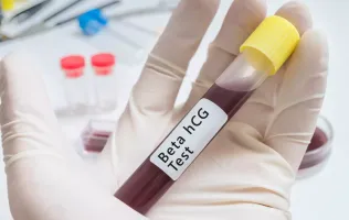 Probówką z krwią na test beta HCG - Salve aktualności