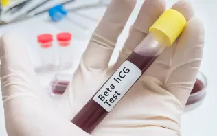 Beta HCG z krwi