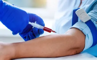 Jakie badania krwi trzeba wykonywać na czczo?