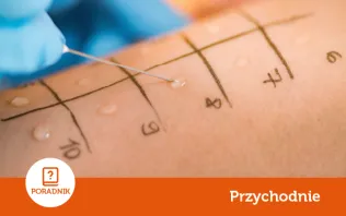 Jak wyglądają testy alergologiczne? Kiedy je zrobić?