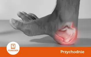 Ostroga piętowa - jakie daje objawy i jak ją leczyć?