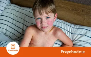 Wysypka u dziecka – co ją najczęściej powoduje.webp