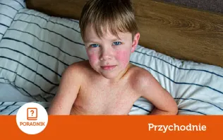 Wysypka u dziecka - co ją najczęściej powoduje? Przyczyny, diagnostyka i leczenie
