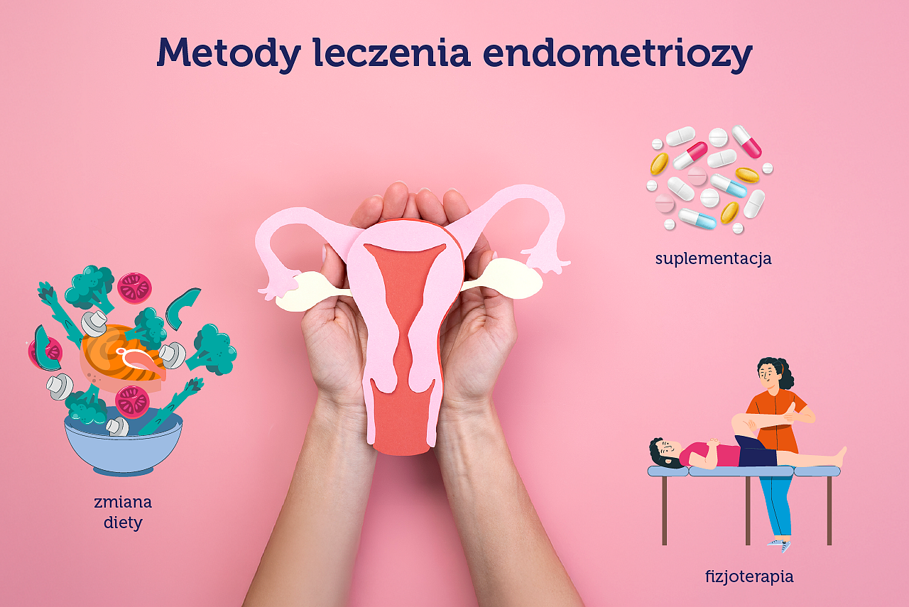metody leczenia endometriozy.png [1.15 MB]