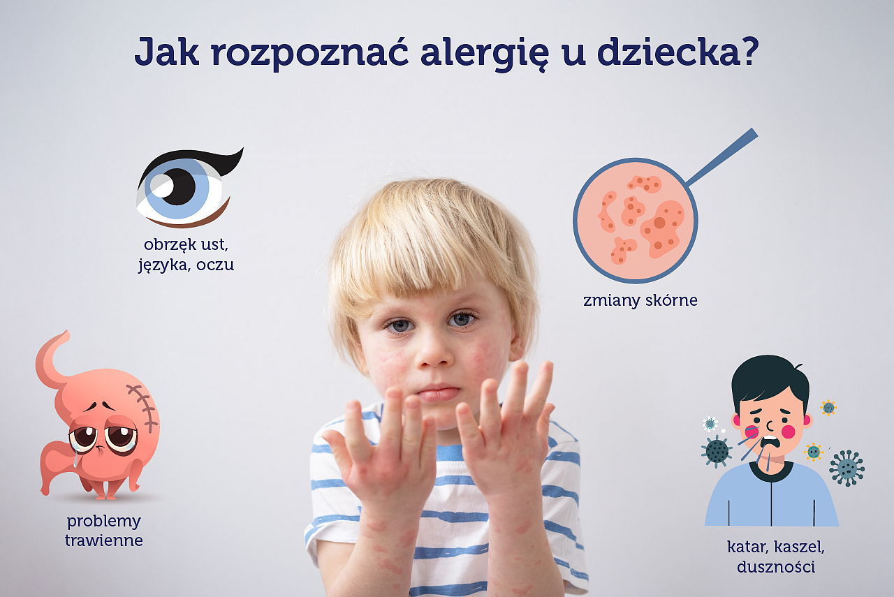 jak rozpoznac alergie u dziecka.png [1.03 MB]