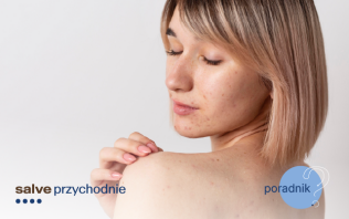 Przebarwienia na twarzy od słońca - jak się ich pozbyć?