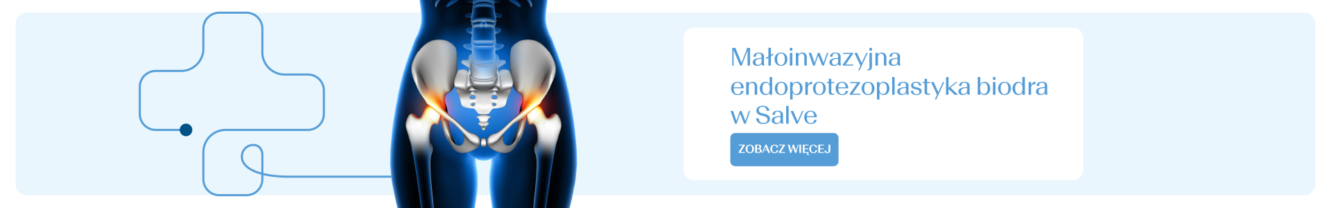 endoprotezoplastyka biodra 1920x300 2.png