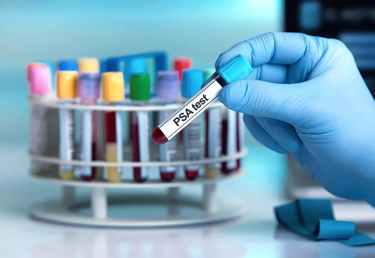 Dłoń w medycznej rękawiczce trzyma probówkę z krwią na badanie PSA na tle innych laboratoryjnych próbek.
